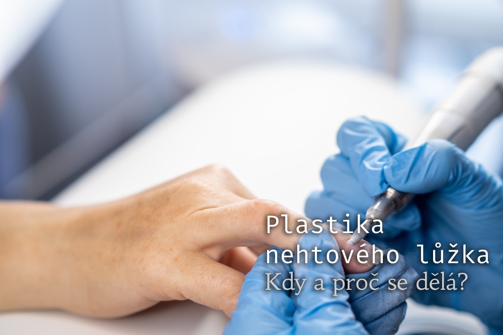 plastika nehtového lůžka